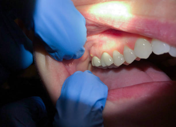 Best Emergency Dentist for Special Needs Patients in New Baltimore, OH