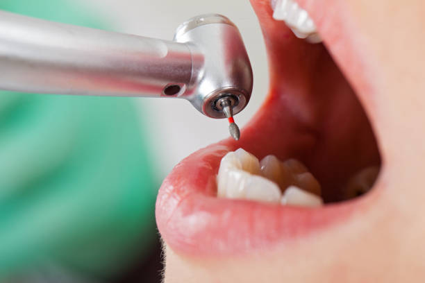 Best Broken or Cracked Tooth Emergency Dentist in New Baltimore, OH